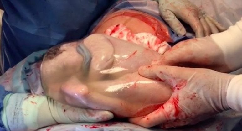 magia do parto - bebé em saco amniótico
